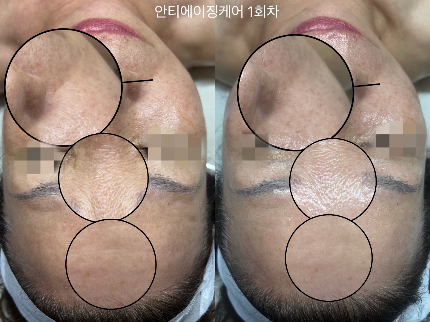 제뉴인 에스테틱