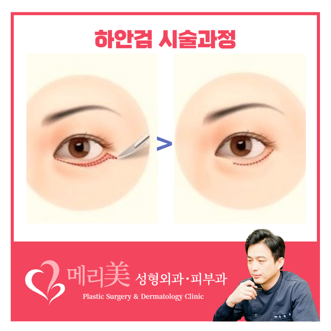 메리미의원