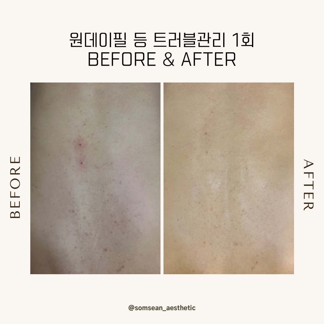 솜세안피부샵 대표 이미지