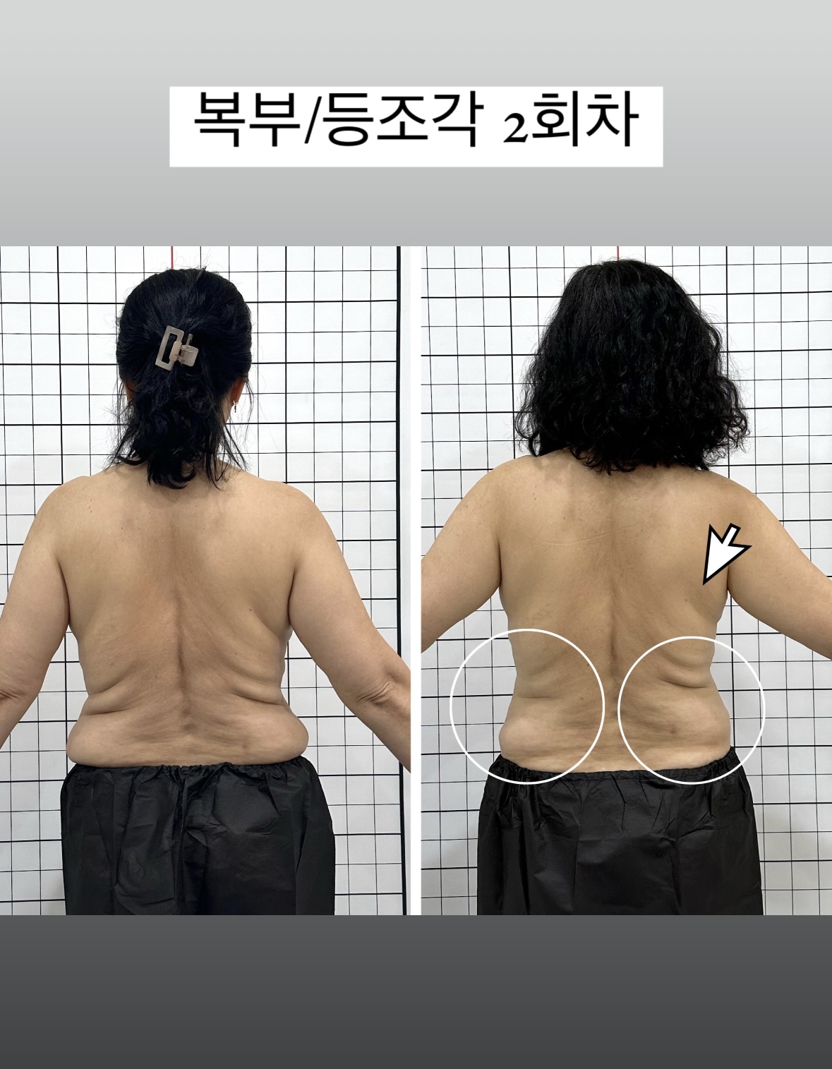 더예쁨