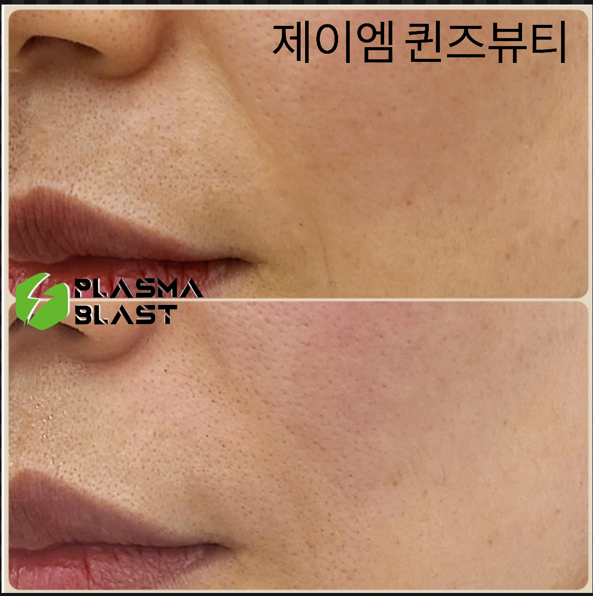 제이엠 퀸즈뷰티 플라즈마 대표 이미지