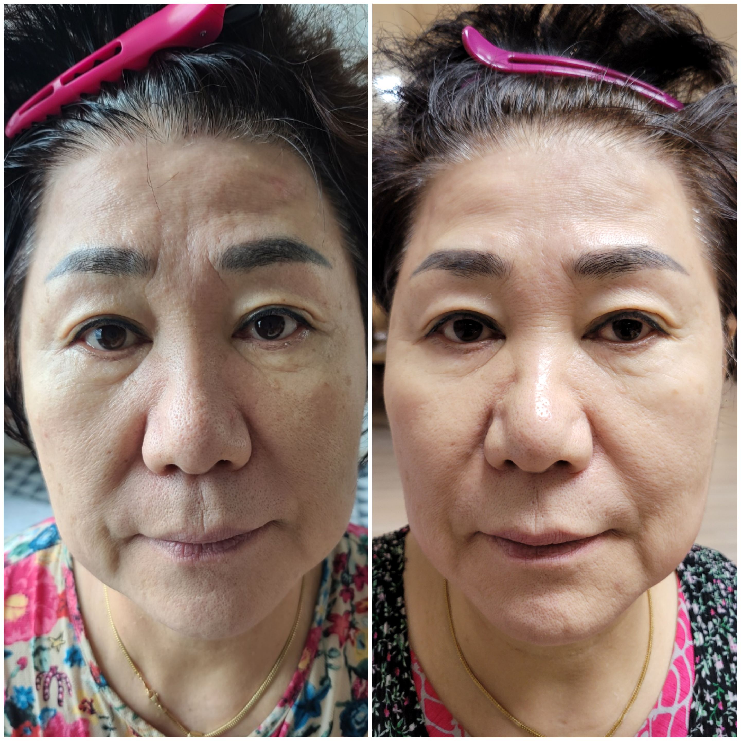 인셀덤 B&B목포대리점