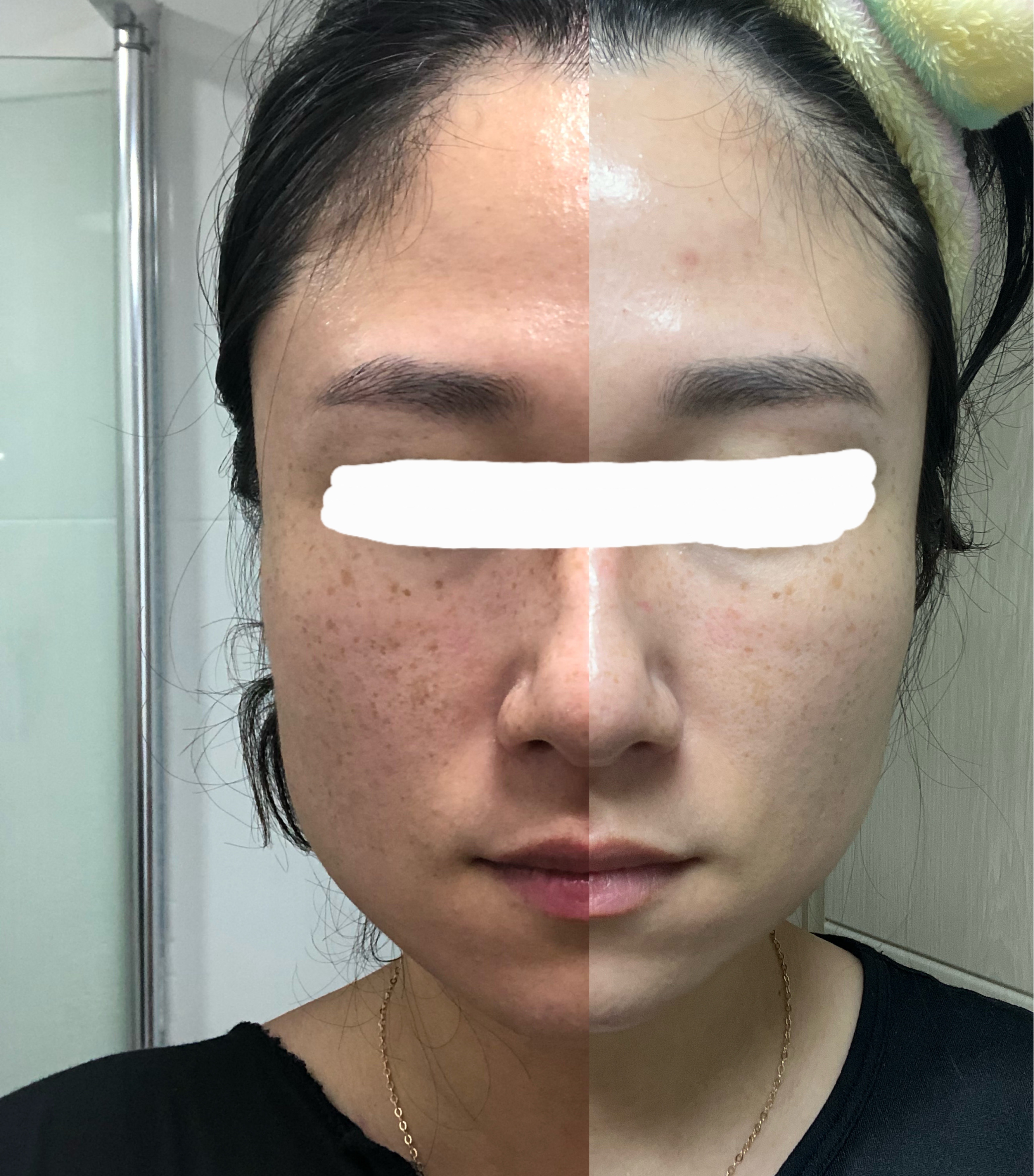 인셀덤 B&B목포대리점