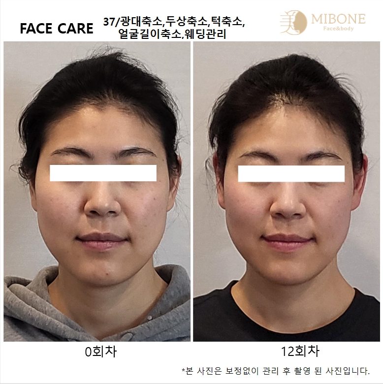 미본 얼굴윤곽관리 일산점 대표 이미지