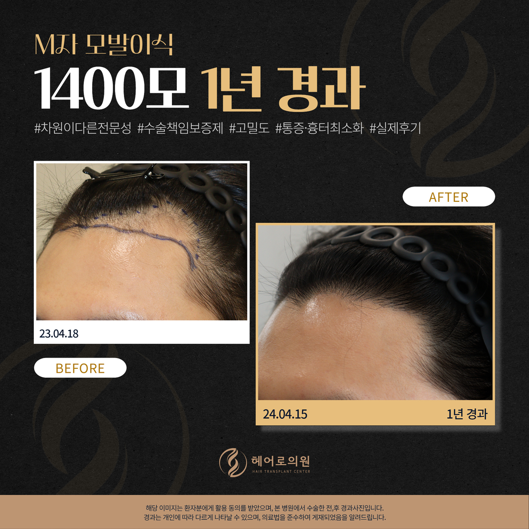 헤어로의원 대구