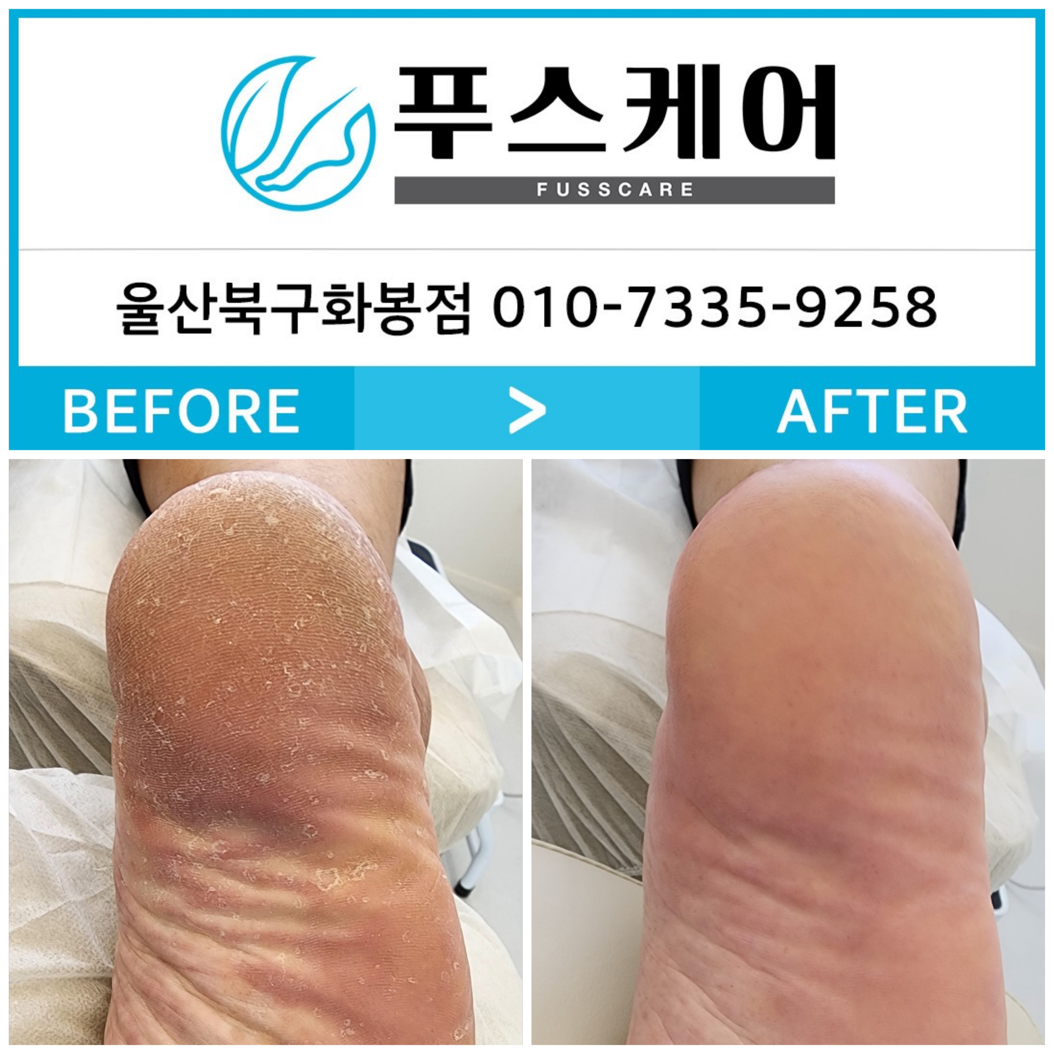 푸스케어 울산북구화봉점