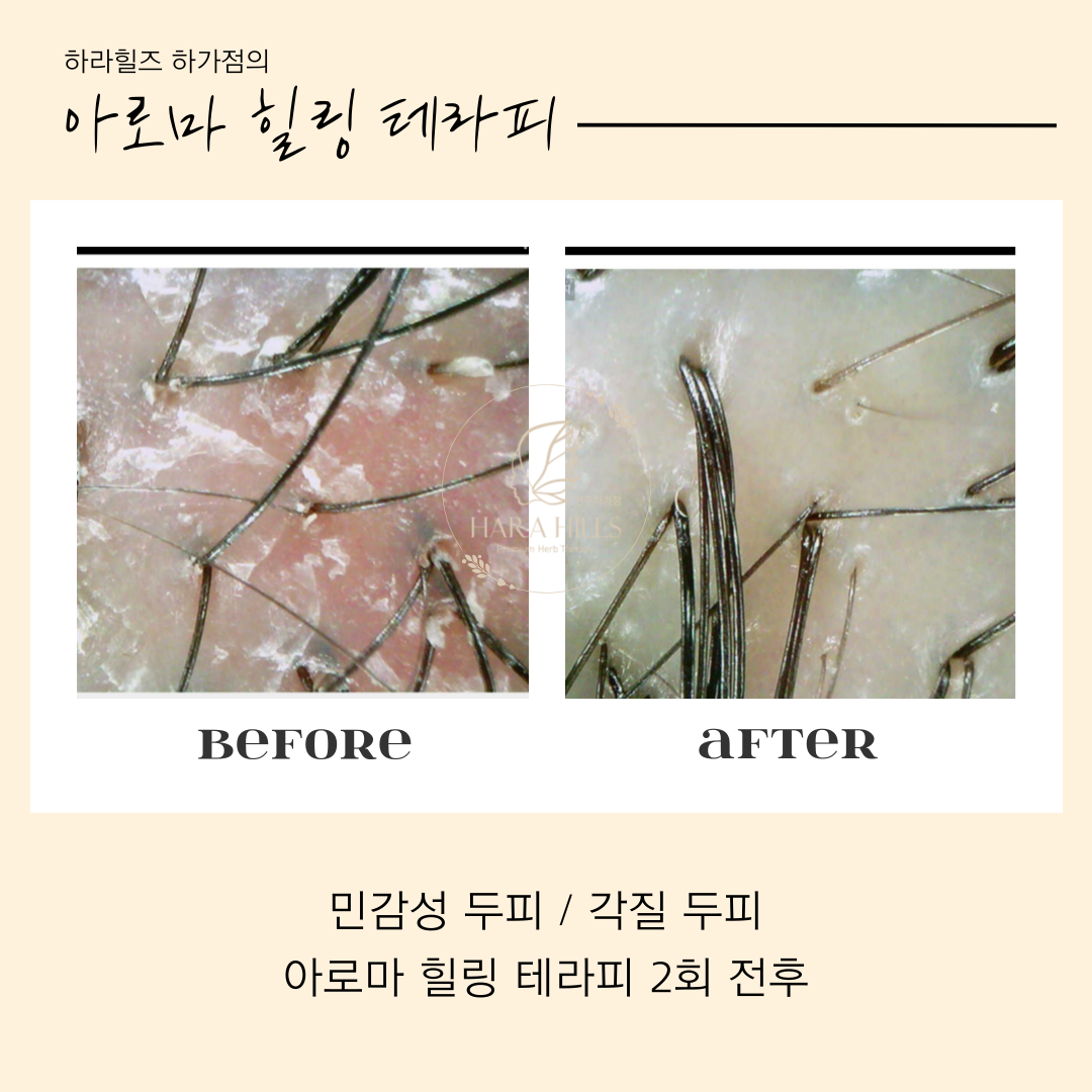 하라힐즈 하가점