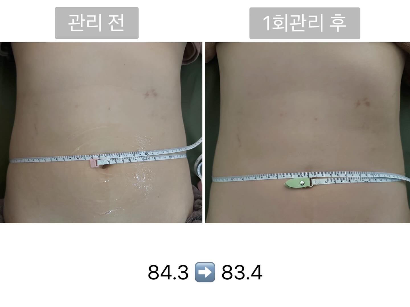 니쥬테라피