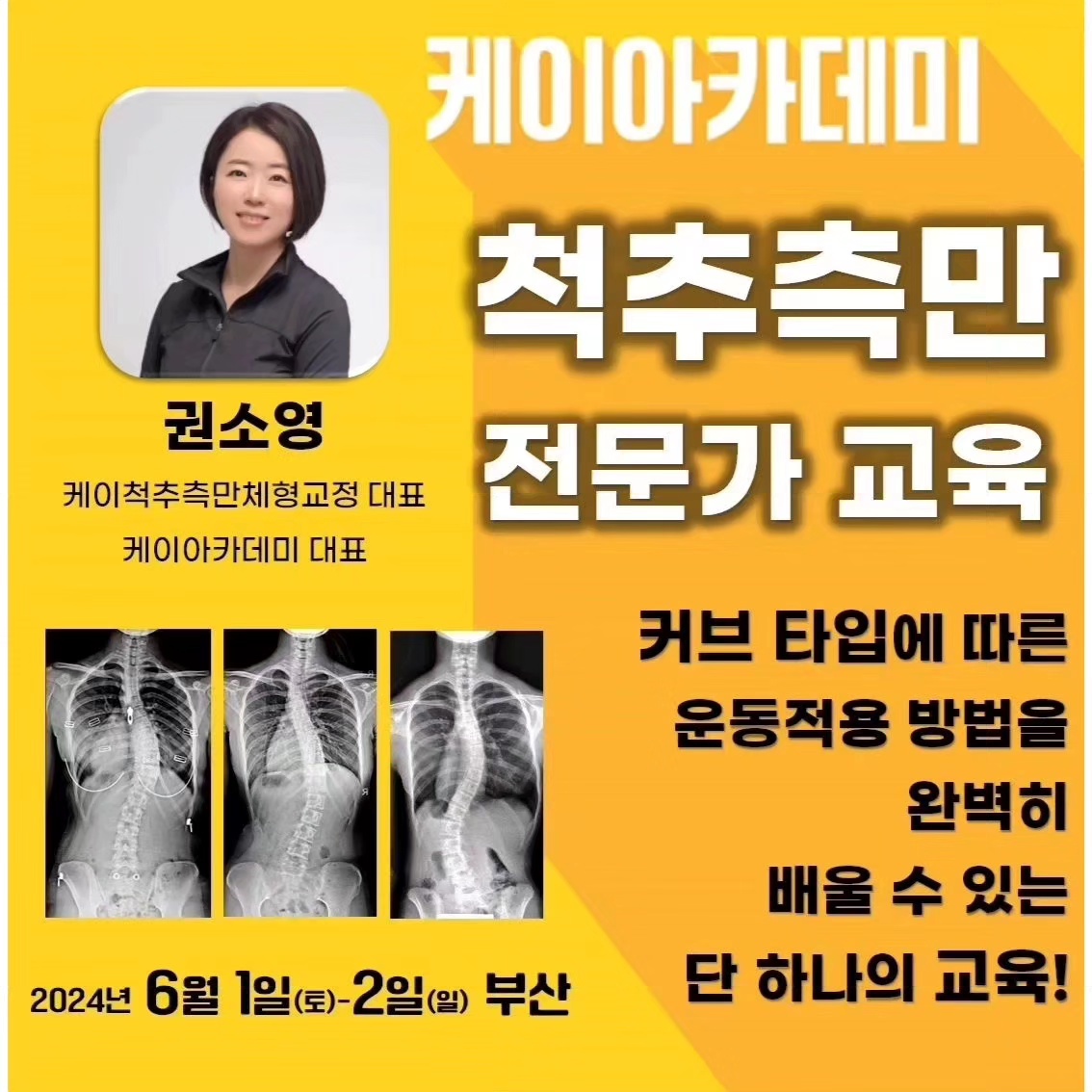 케이척추측만체형교정 대표 이미지