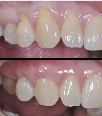 다라플란트치과의원 대표 이미지