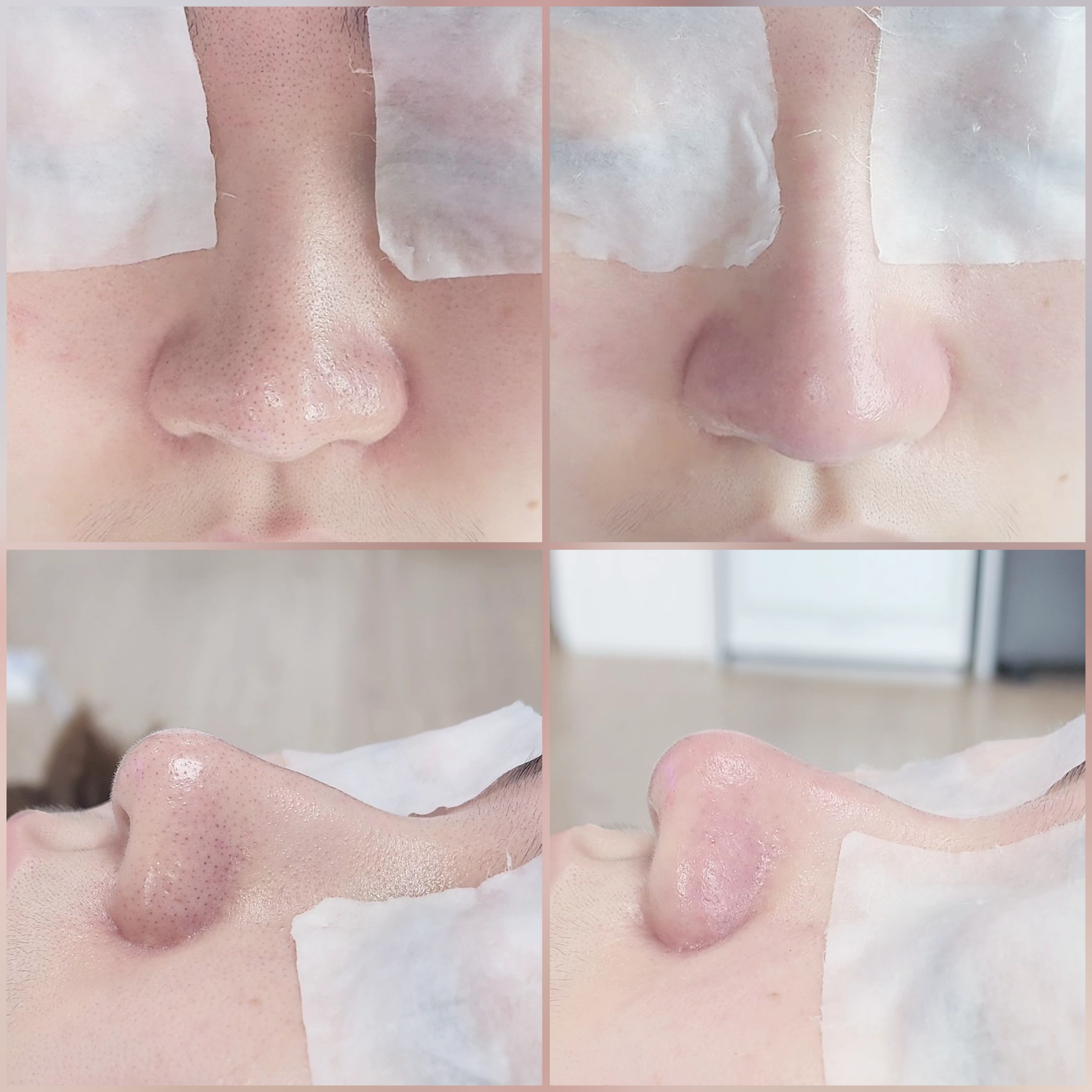 블랙헤드 코피다 수원점 대표 이미지