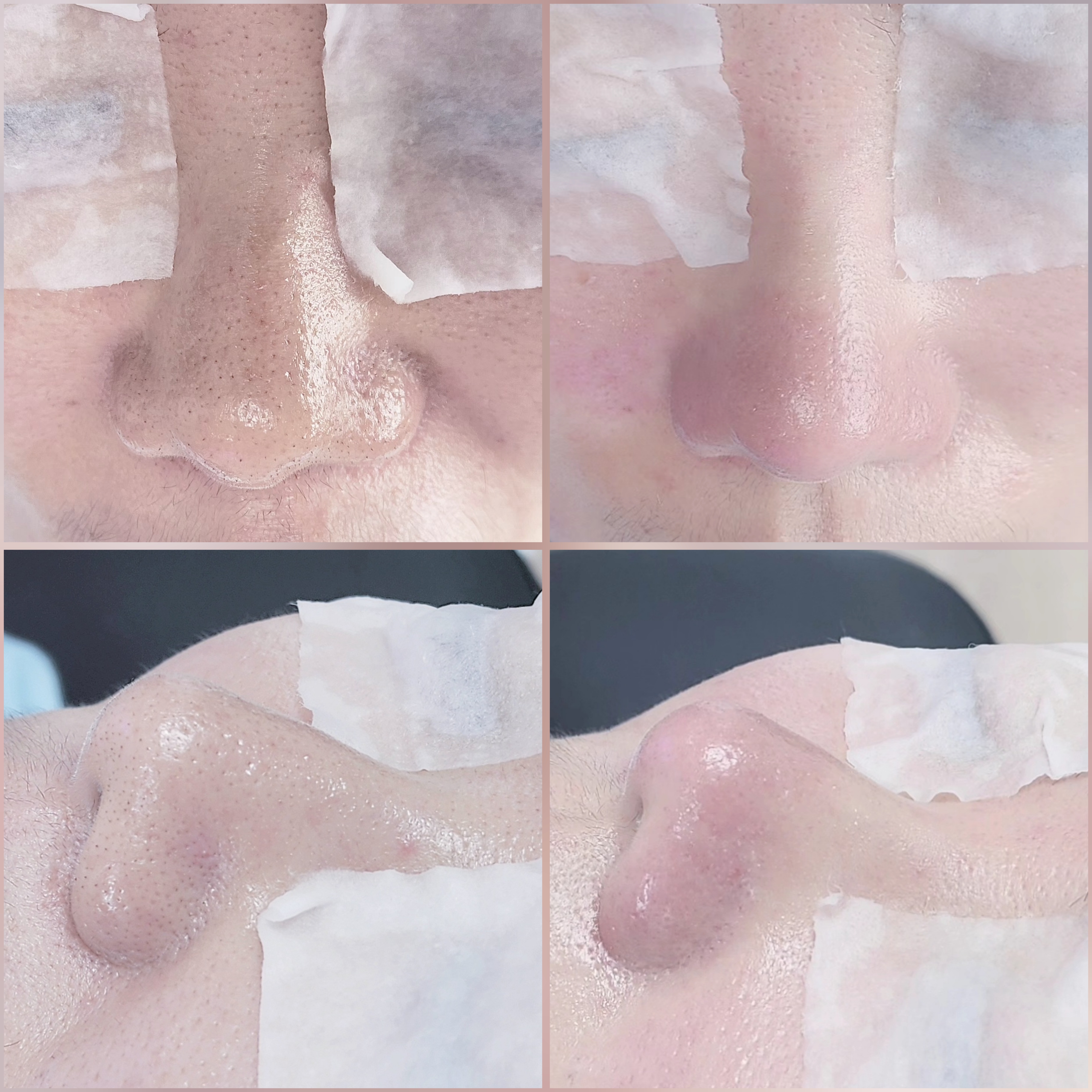 블랙헤드 코피다 수원점 대표 이미지