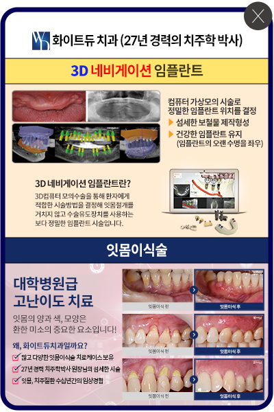화이트듀치과의원 울산
