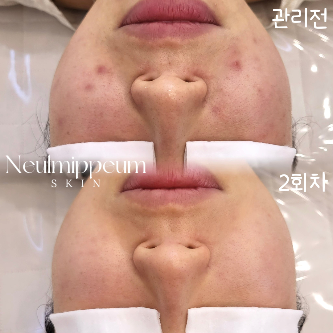 늘미쁨스킨 평택고덕본점 대표 이미지