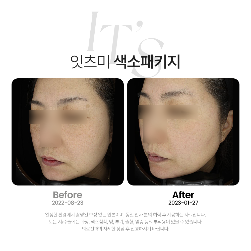 잇츠미의원 천안불당