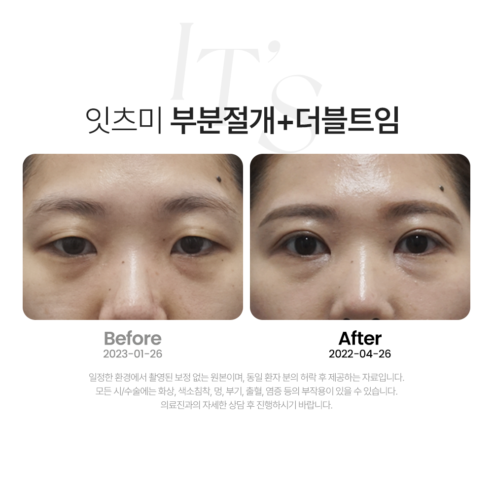 잇츠미의원 대표 이미지