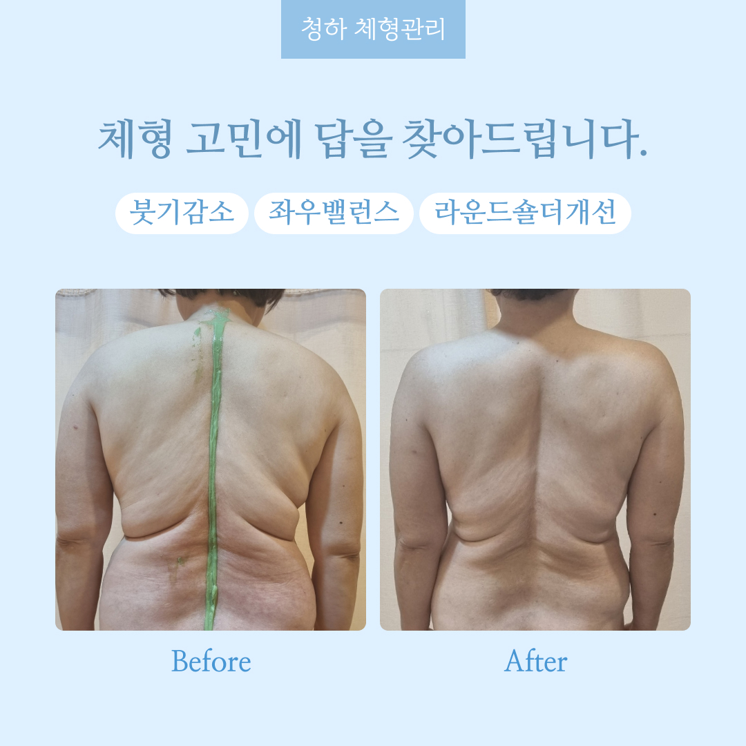 청하 체형관리 photo 2