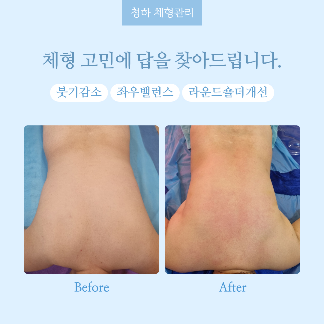 청하 체형관리 photo 3
