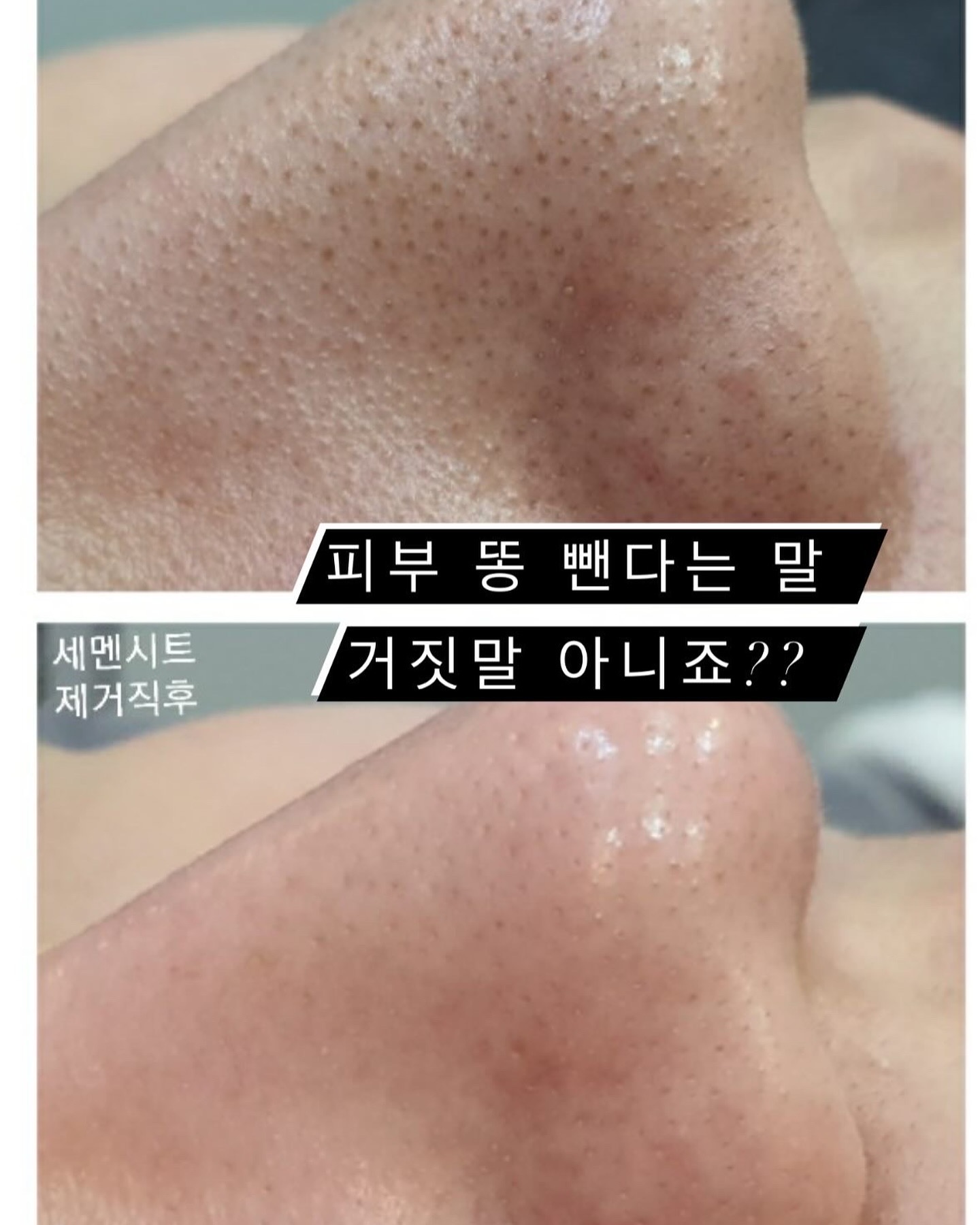 스킨플러스 대표 이미지