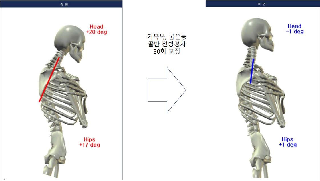 자세체형교정센터밸런스핏 대표 이미지