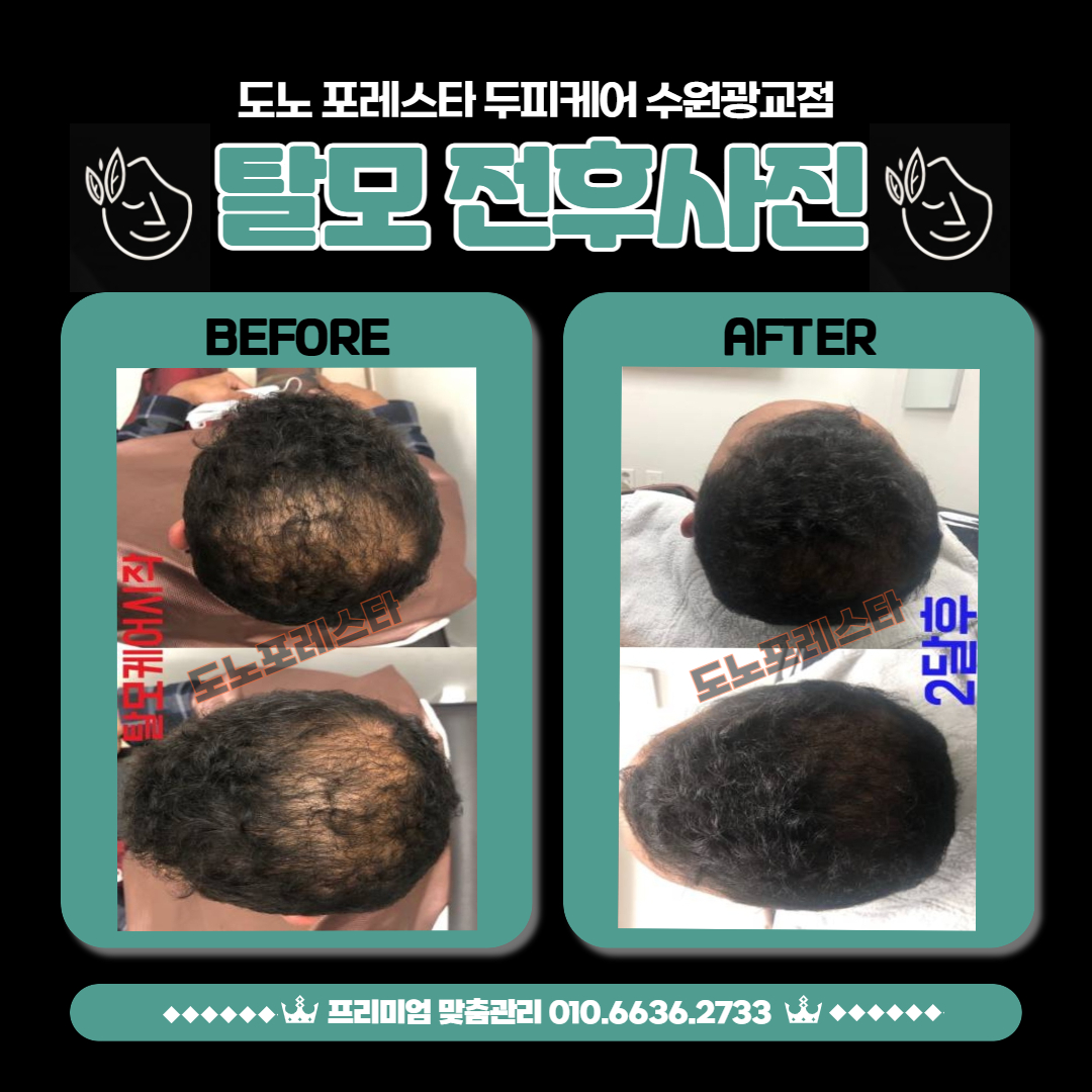 도노포레스타 두피케어 수원광교점