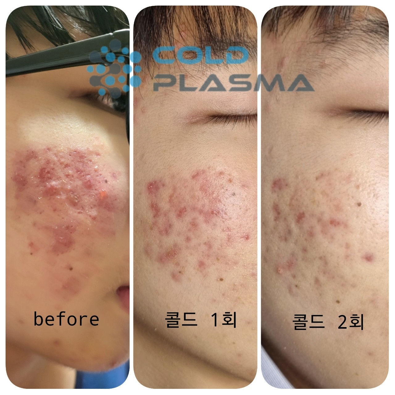 플라즈마블라스트&메리미뷰티 대표 이미지