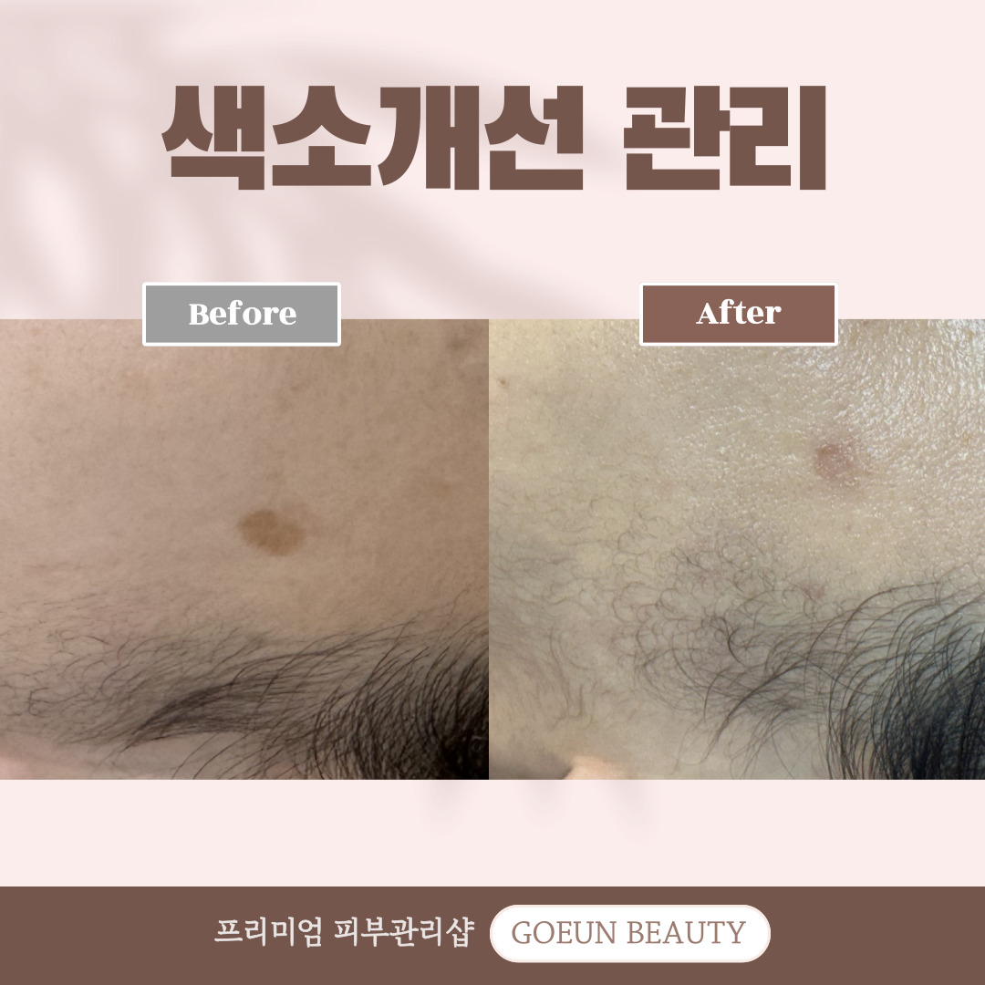 고은뷰티 대표 이미지