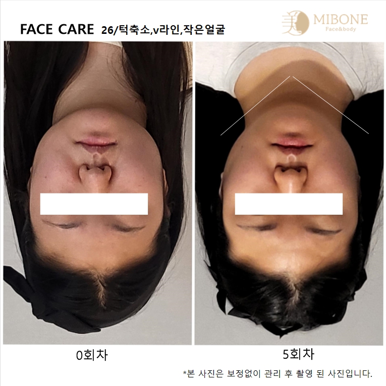 미본 얼굴윤곽관리 일산점 대표 이미지