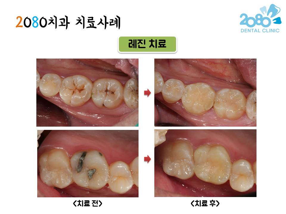 2080치과의원 대표 이미지
