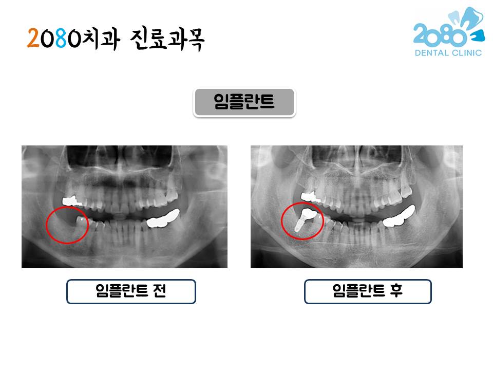 2080치과의원 대표 이미지