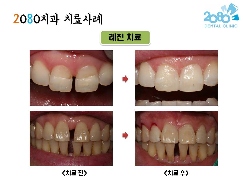 2080치과의원 대표 이미지