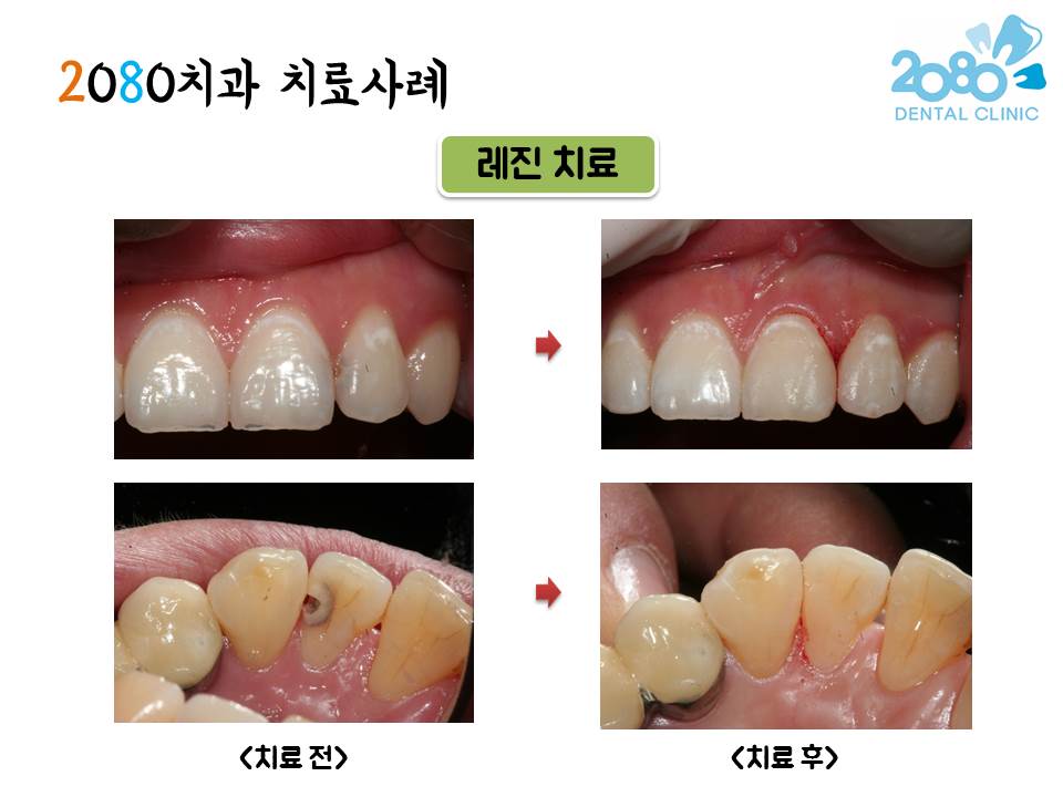 2080치과의원 대표 이미지