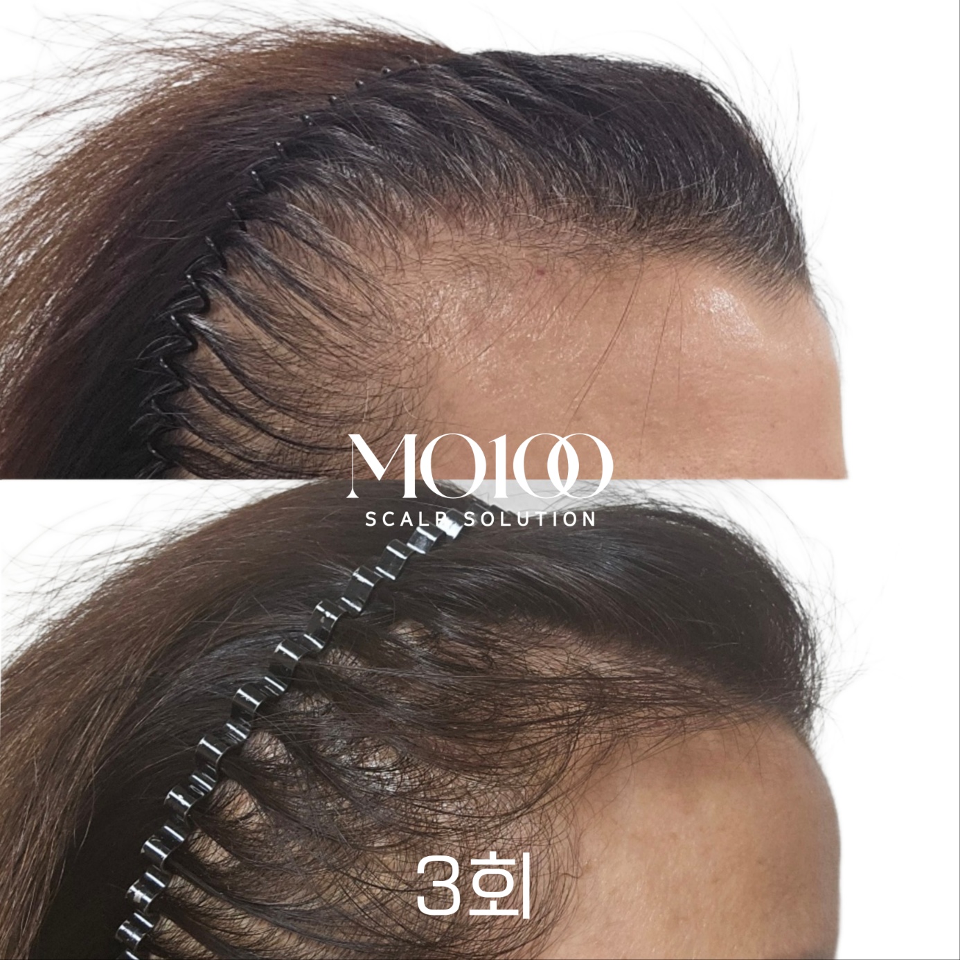 그레이스풀 대표 이미지