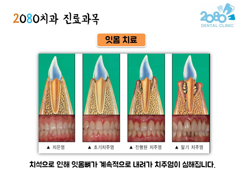 2080치과의원 대표 이미지