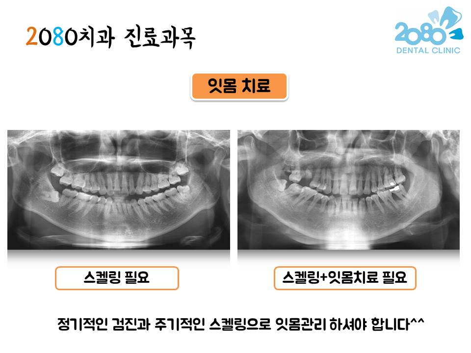 2080치과의원 대표 이미지