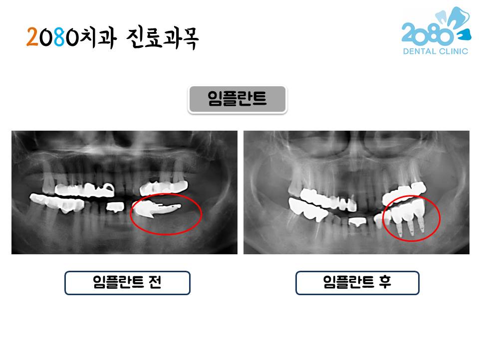 2080치과의원 대표 이미지