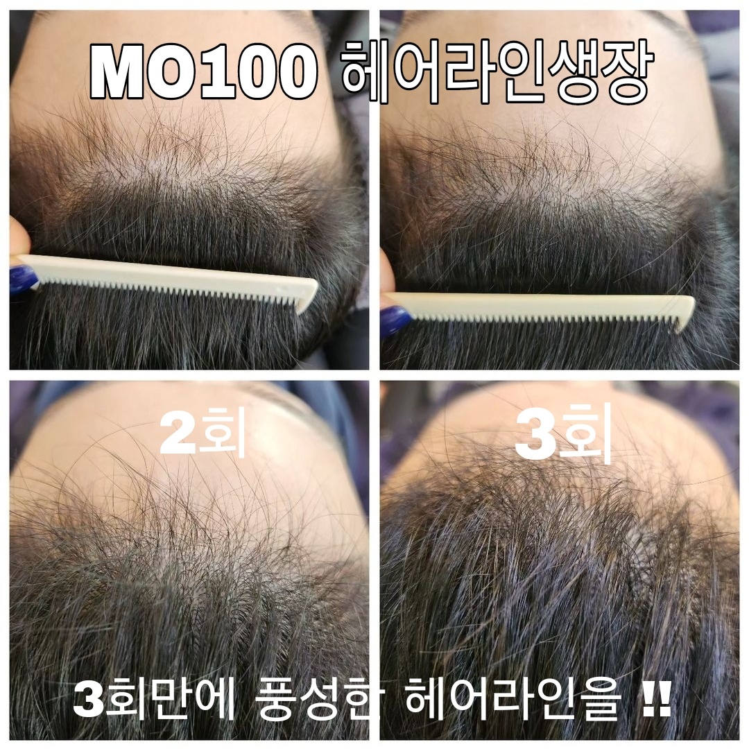 그레이스풀 대표 이미지