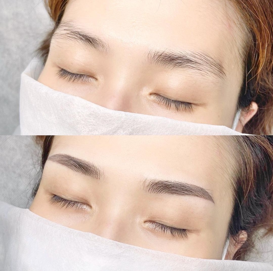 새로나다모발킹 대표 이미지