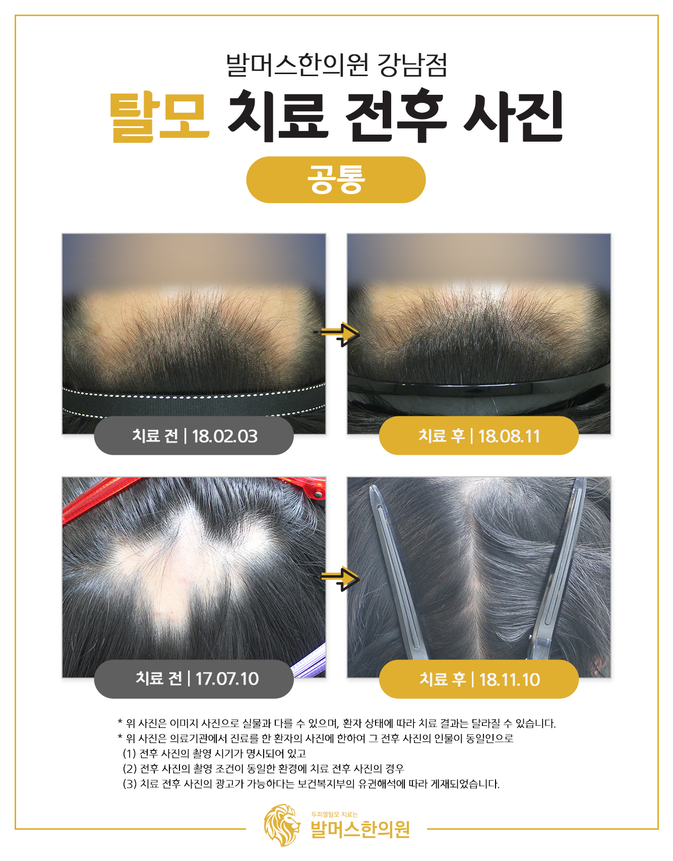 발머스한의원 강남 대표 이미지