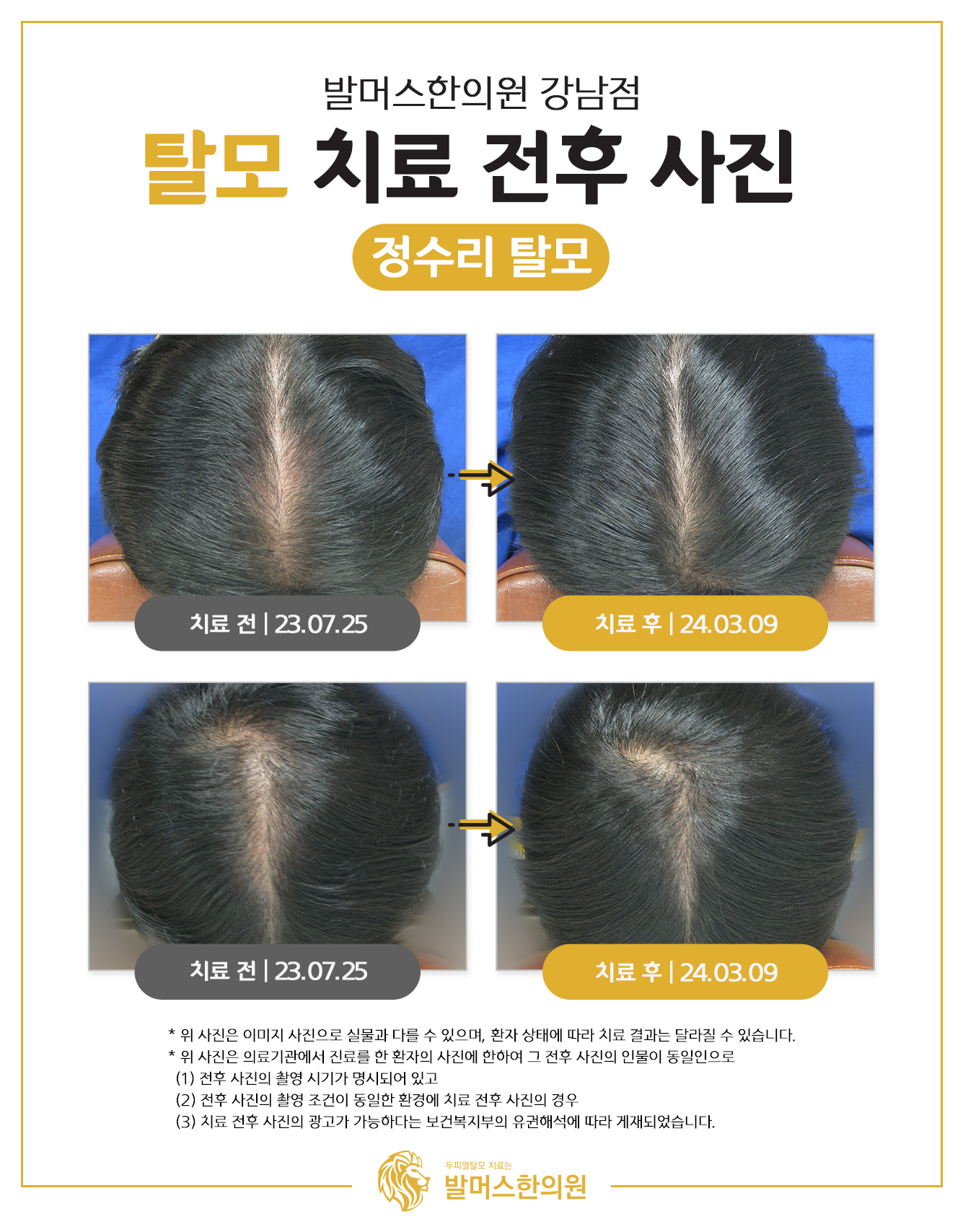 발머스한의원 강남 대표 이미지