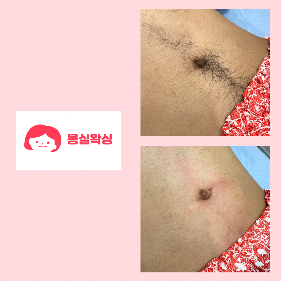 몽실뷰티 대표 이미지