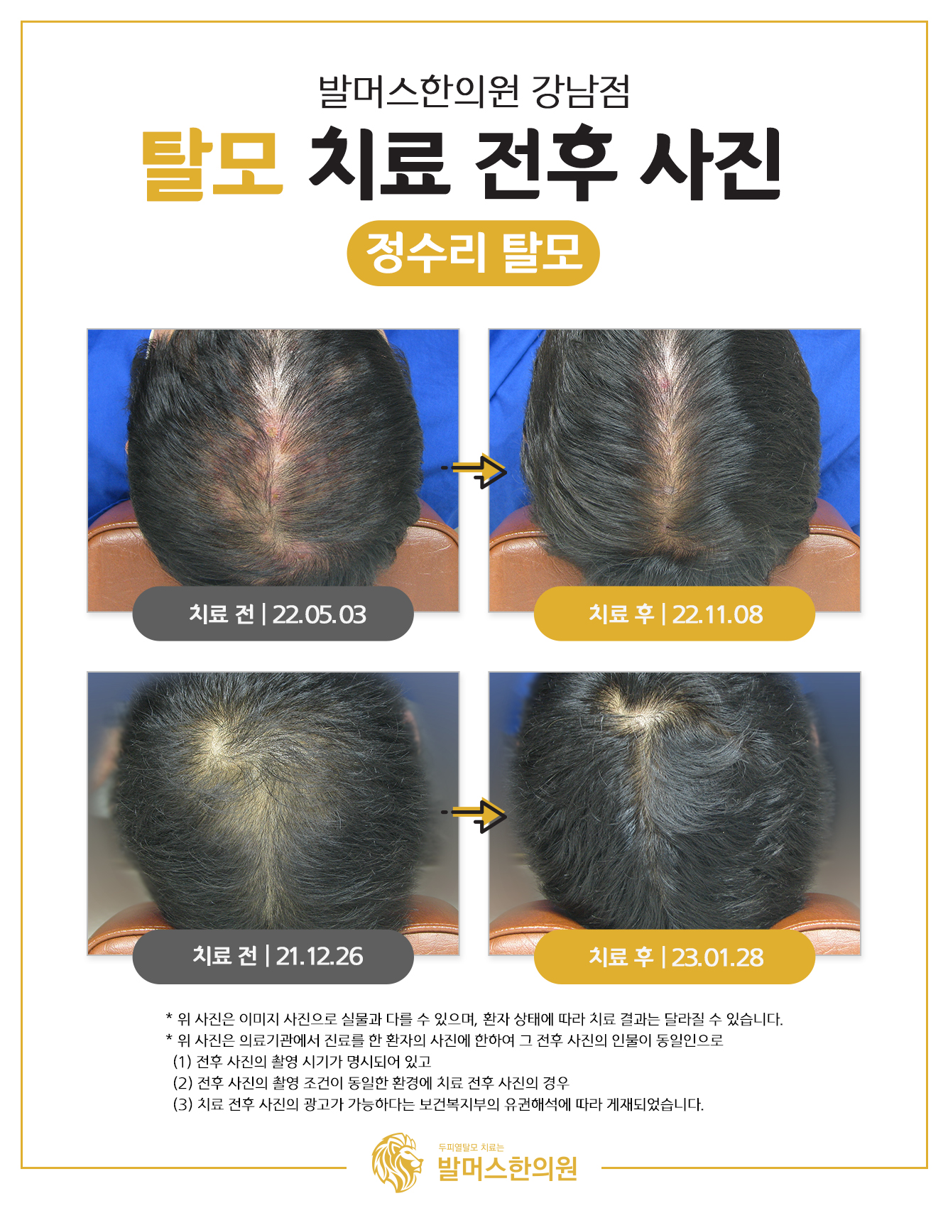 발머스한의원 강남 대표 이미지