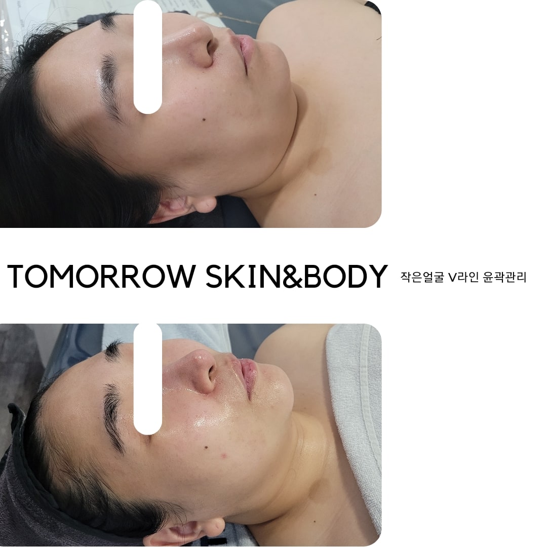 투모로우 스킨엔바디 대표 이미지