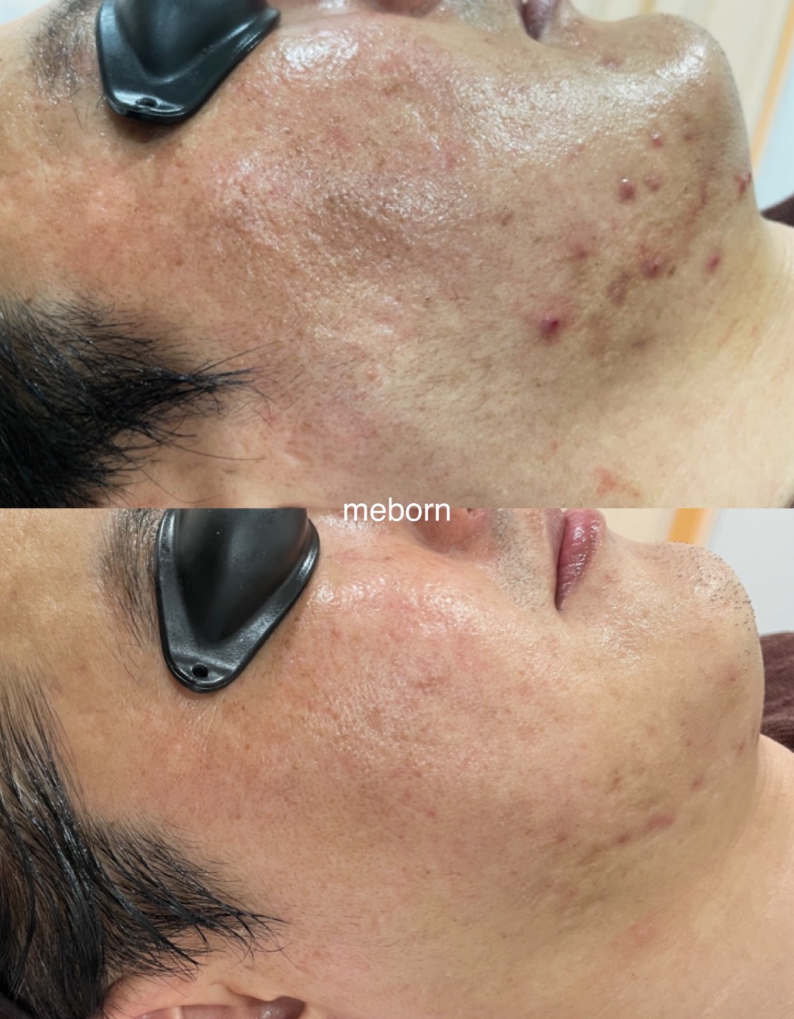 미본에스테틱 대표 이미지