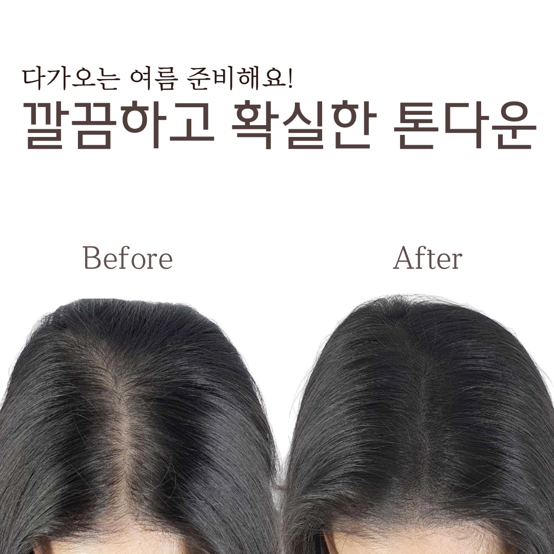 모습두피탈모 세종점 대표 이미지