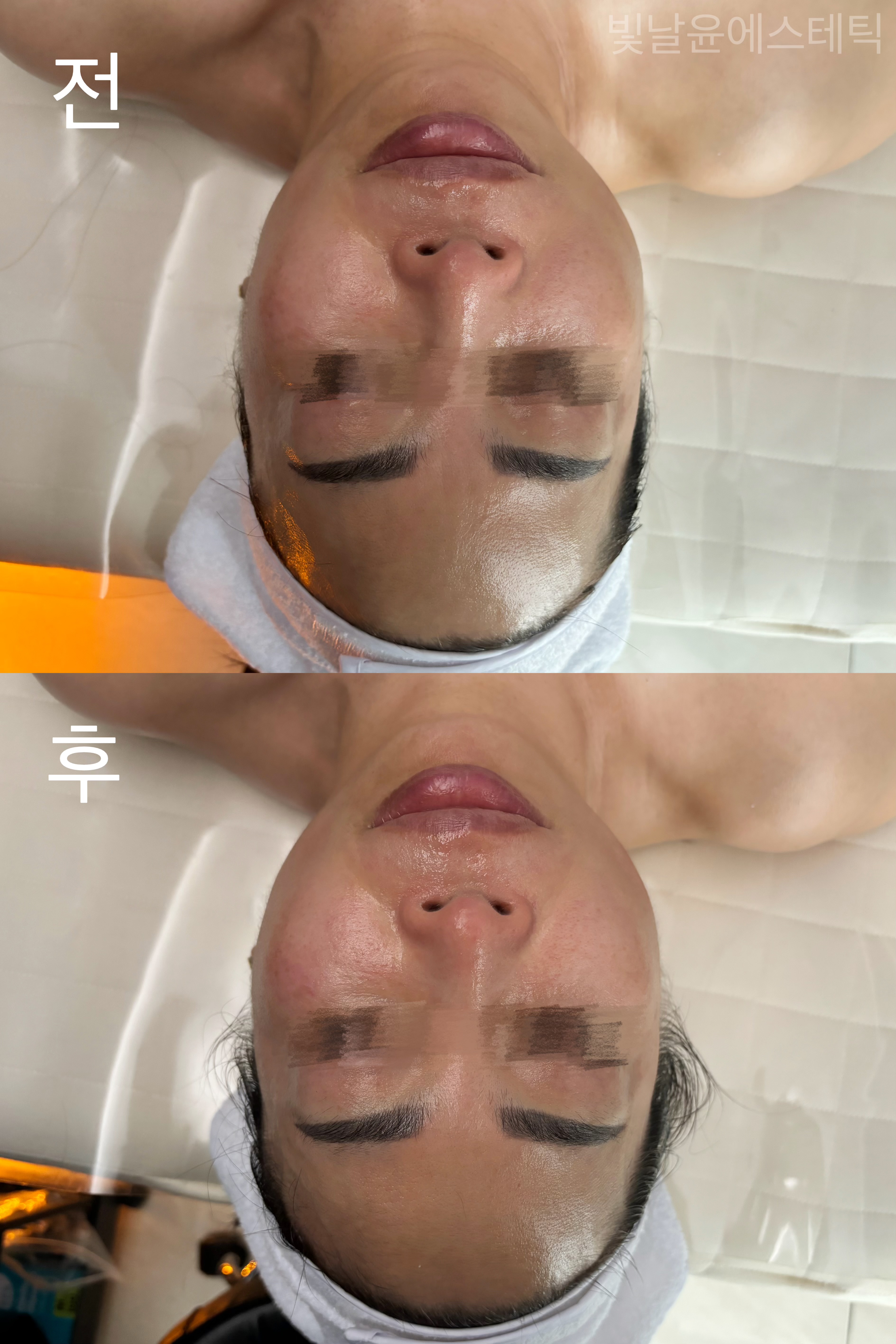 빛날윤 에스테틱