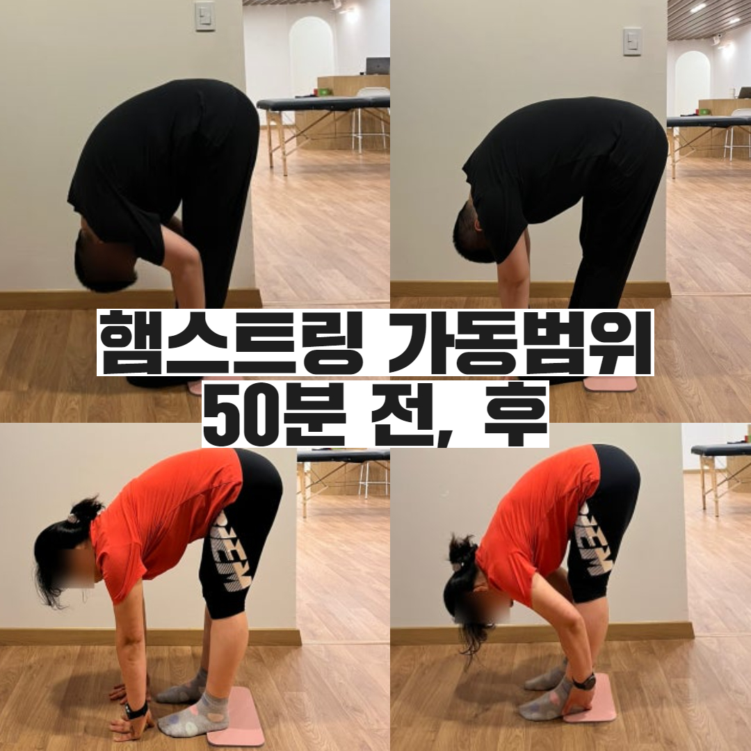 스트레칭조이 대표 이미지