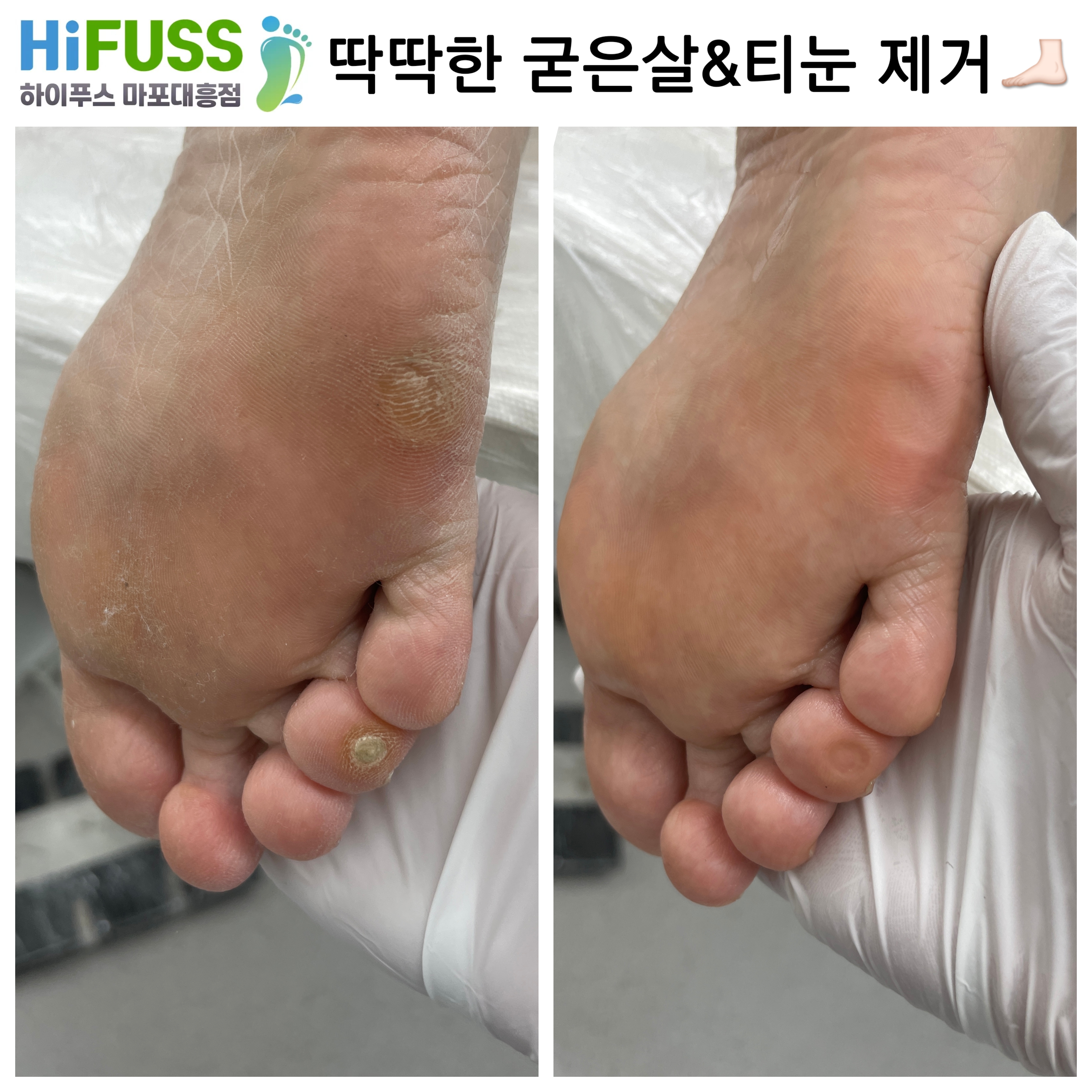 하이푸스 마포대흥점