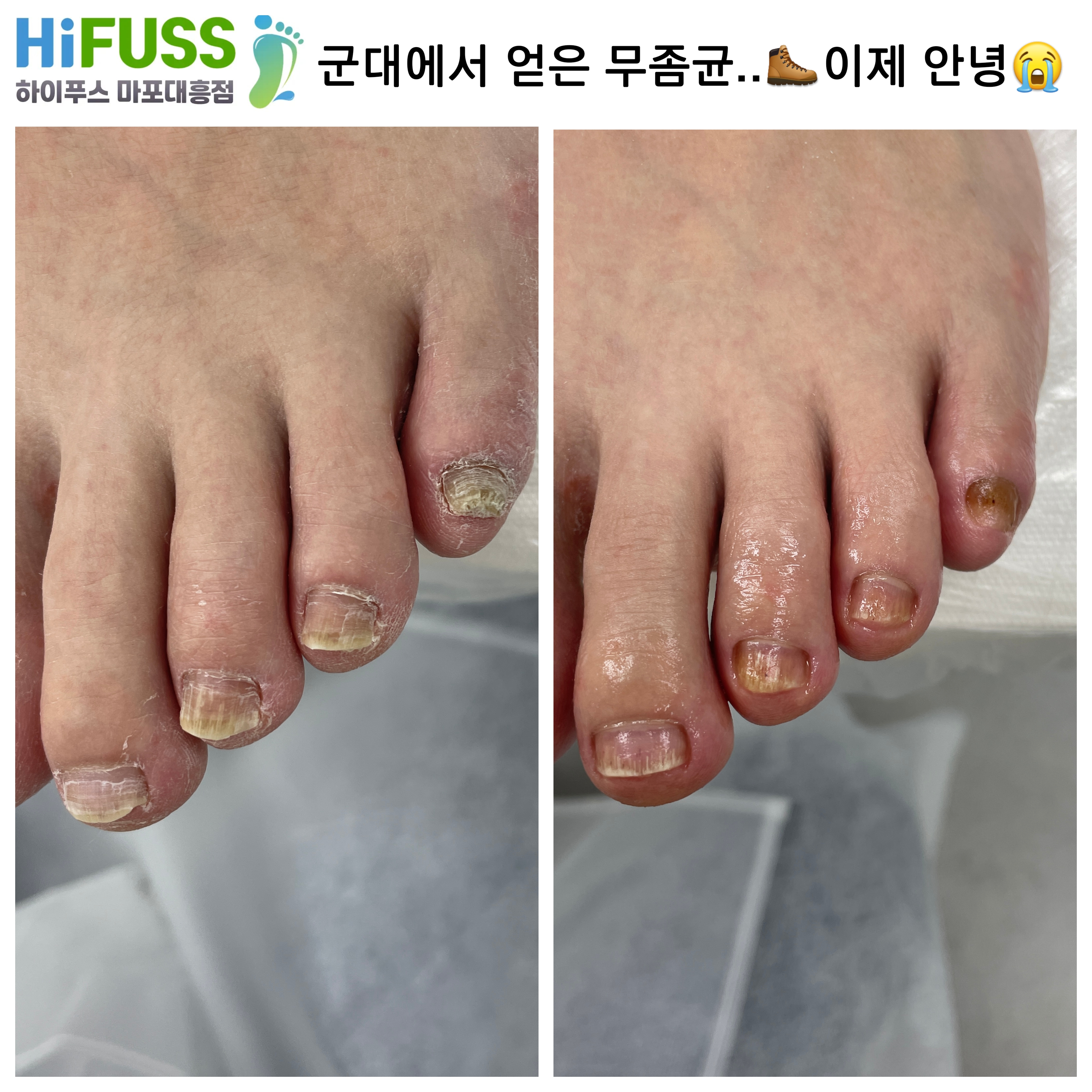 하이푸스 마포대흥점