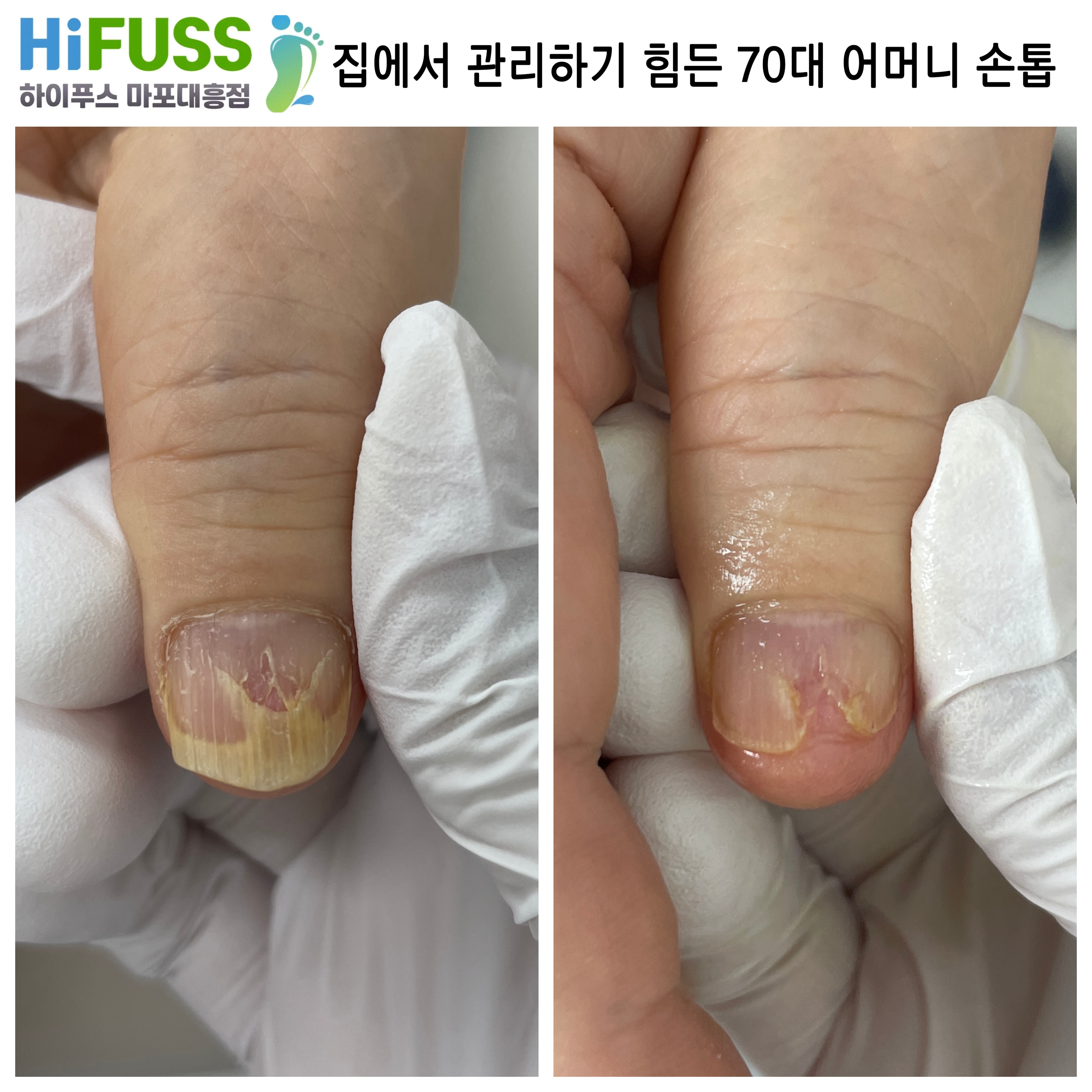 하이푸스 마포대흥점